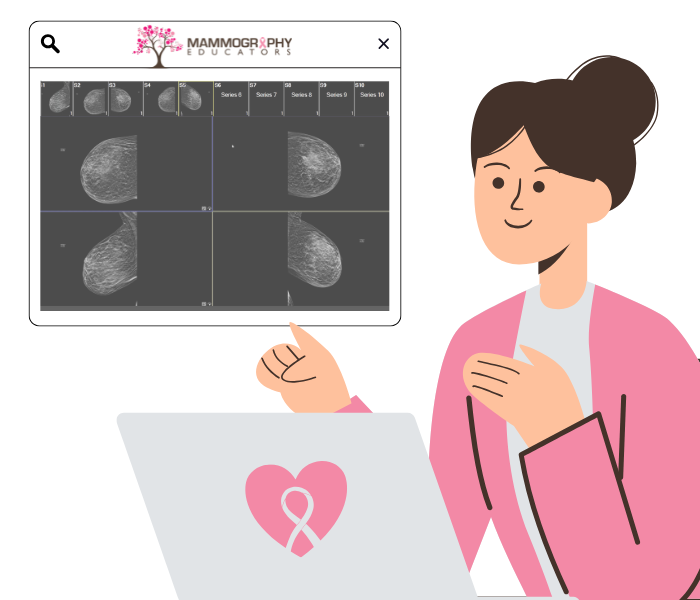 Mammography Positioning Guidebook
